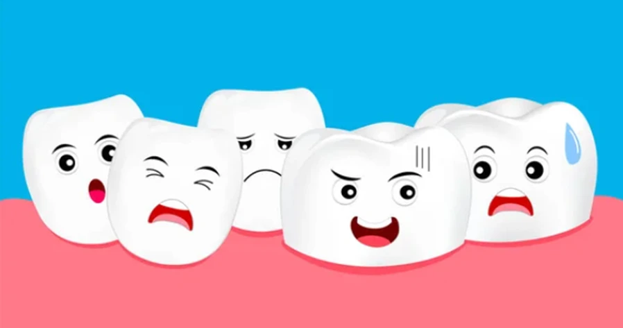 Dental Crowding Illustration