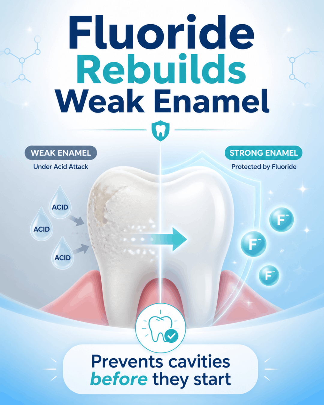 Illustration showing fluoride strengthening weak enamel and protecting teeth from acid to prevent cavities