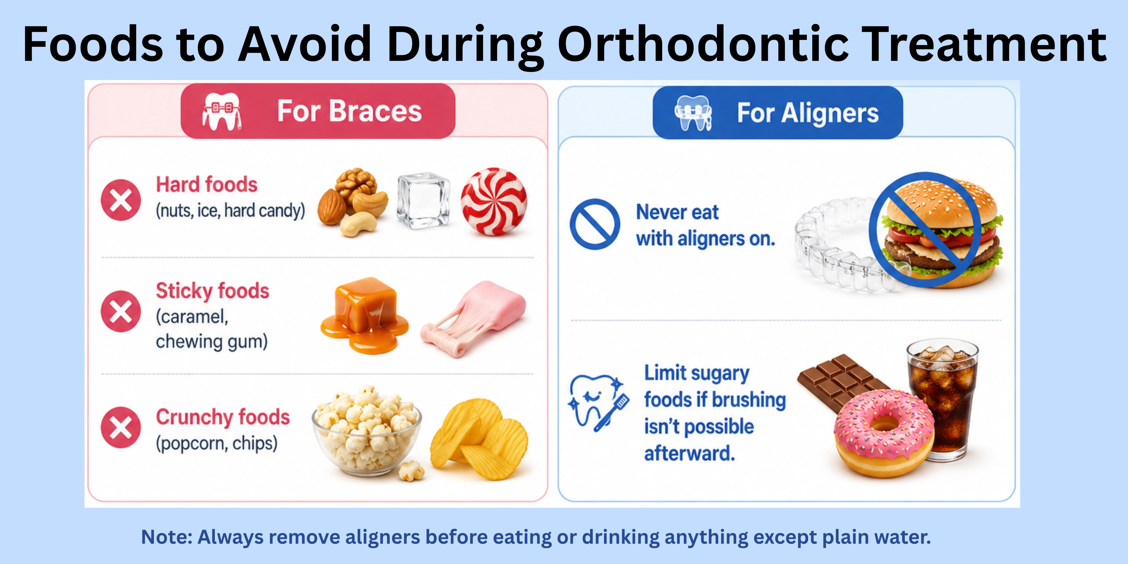 Infographic showing foods to avoid during orthodontic treatment, including hard, sticky, and crunchy foods for braces, and guidelines for aligners such as not eating while wearing them and avoiding placing them back after sugary foods without brushing.