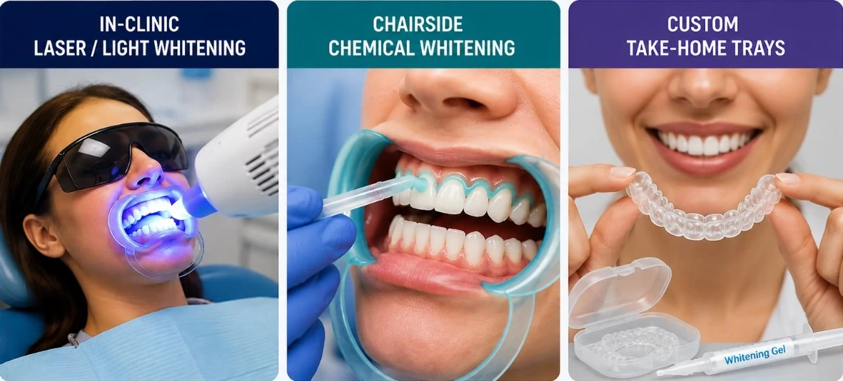 A three-panel infographic detailing professional teeth whitening methods. The first panel is labeled 